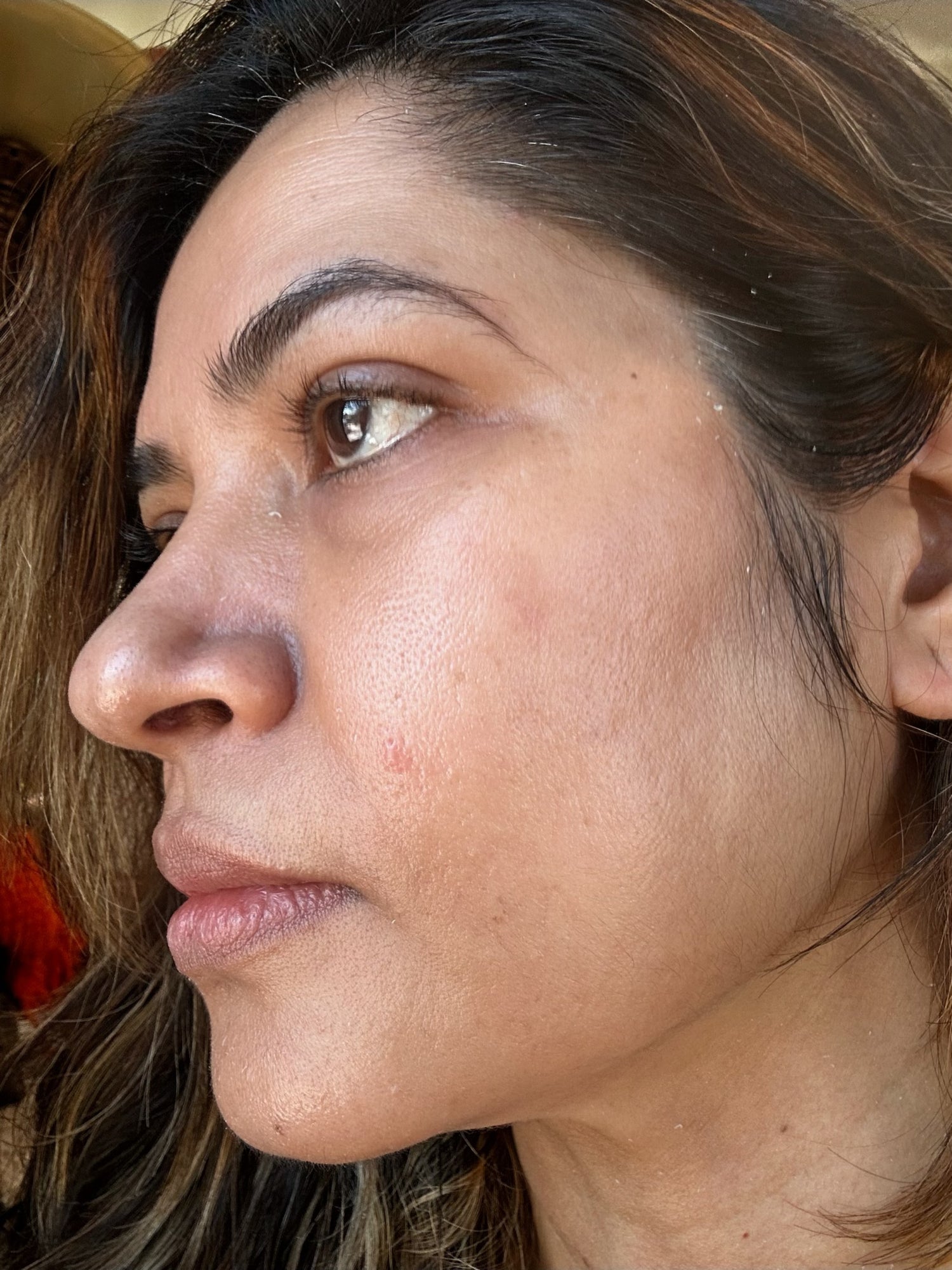 image comparison after