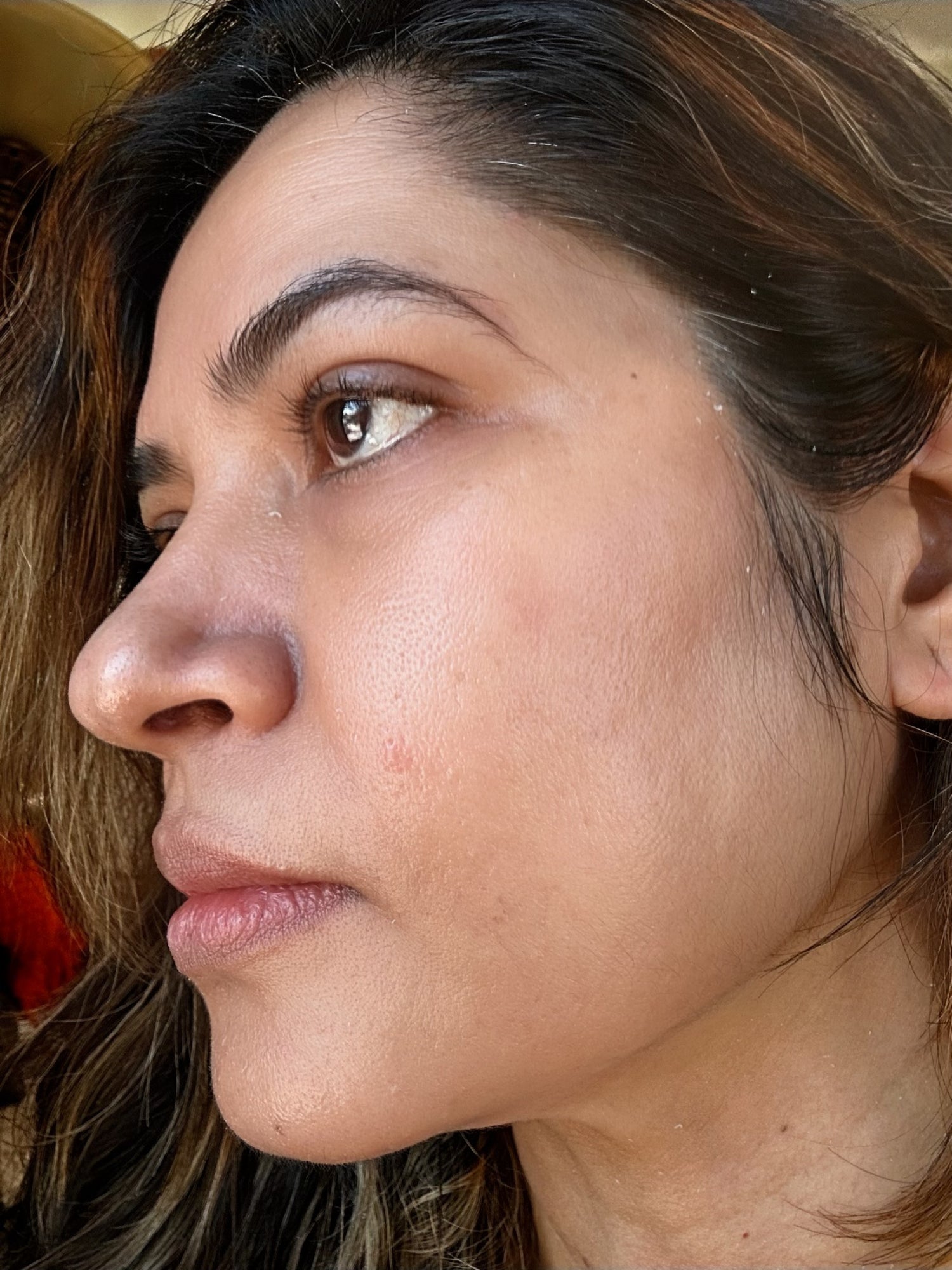 image comparison after