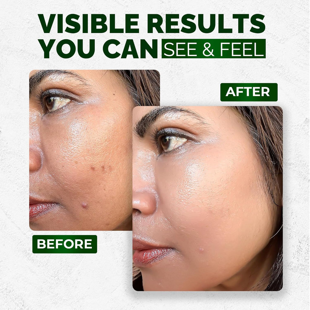 MegPep Serum