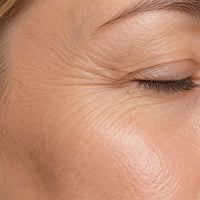 Fine Lines & Aging