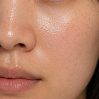 Oily